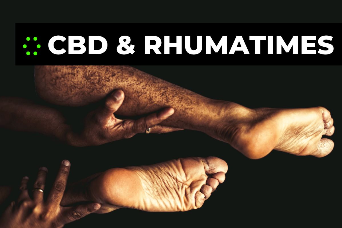 You are currently viewing Diminuer les souffrances causées par les rhumatismes grâce aux perles de CBD !